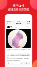愛(ài)病理3