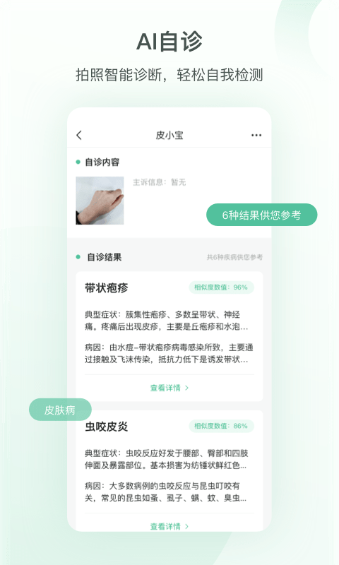 皮小寶2