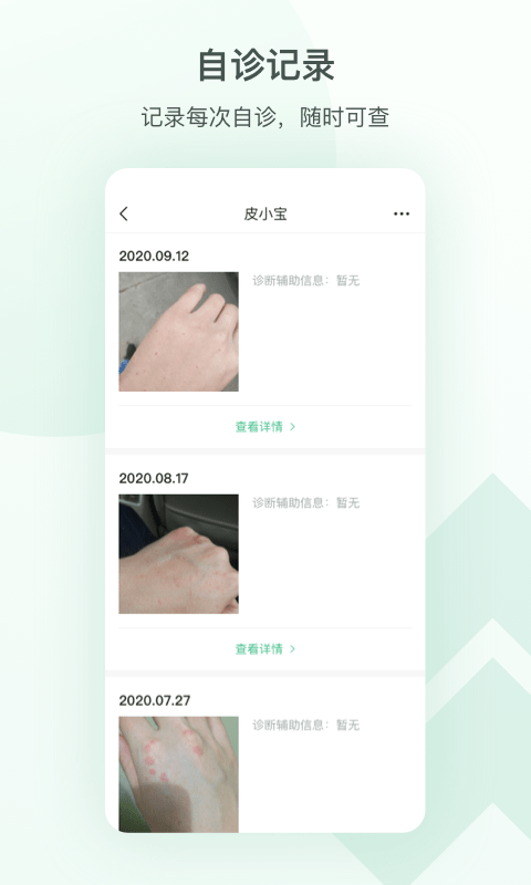 皮小寶3
