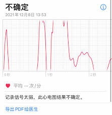 Apple Watch如何查看心電圖